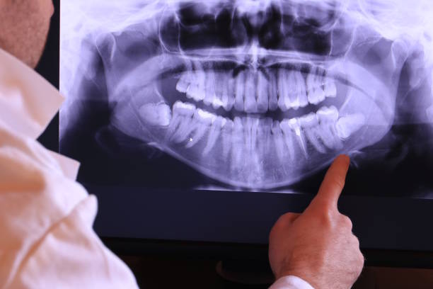 Best Emergency Dentist for Knocked-Out Tooth in Prescott, AR