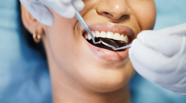 Best Emergency Dentist for Lost Fillings or Crowns in Prescott, AR